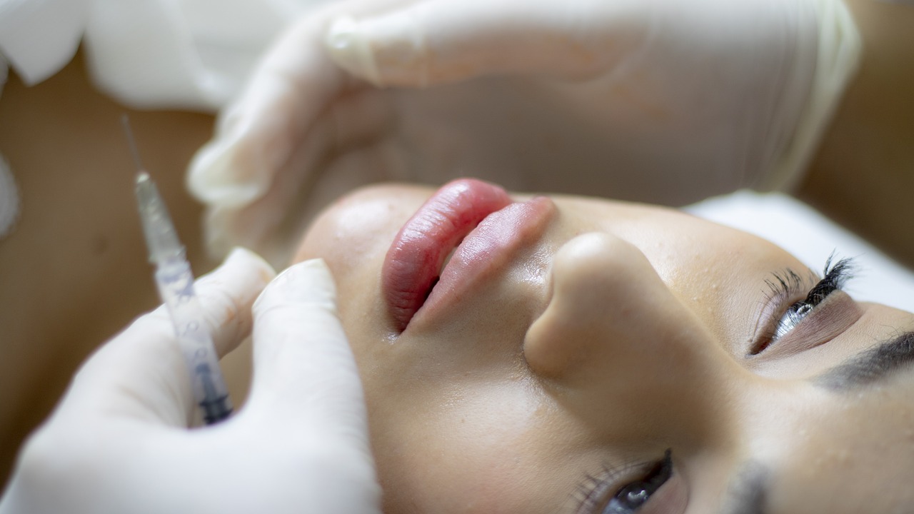 Woman using dermal fillers for lip volume