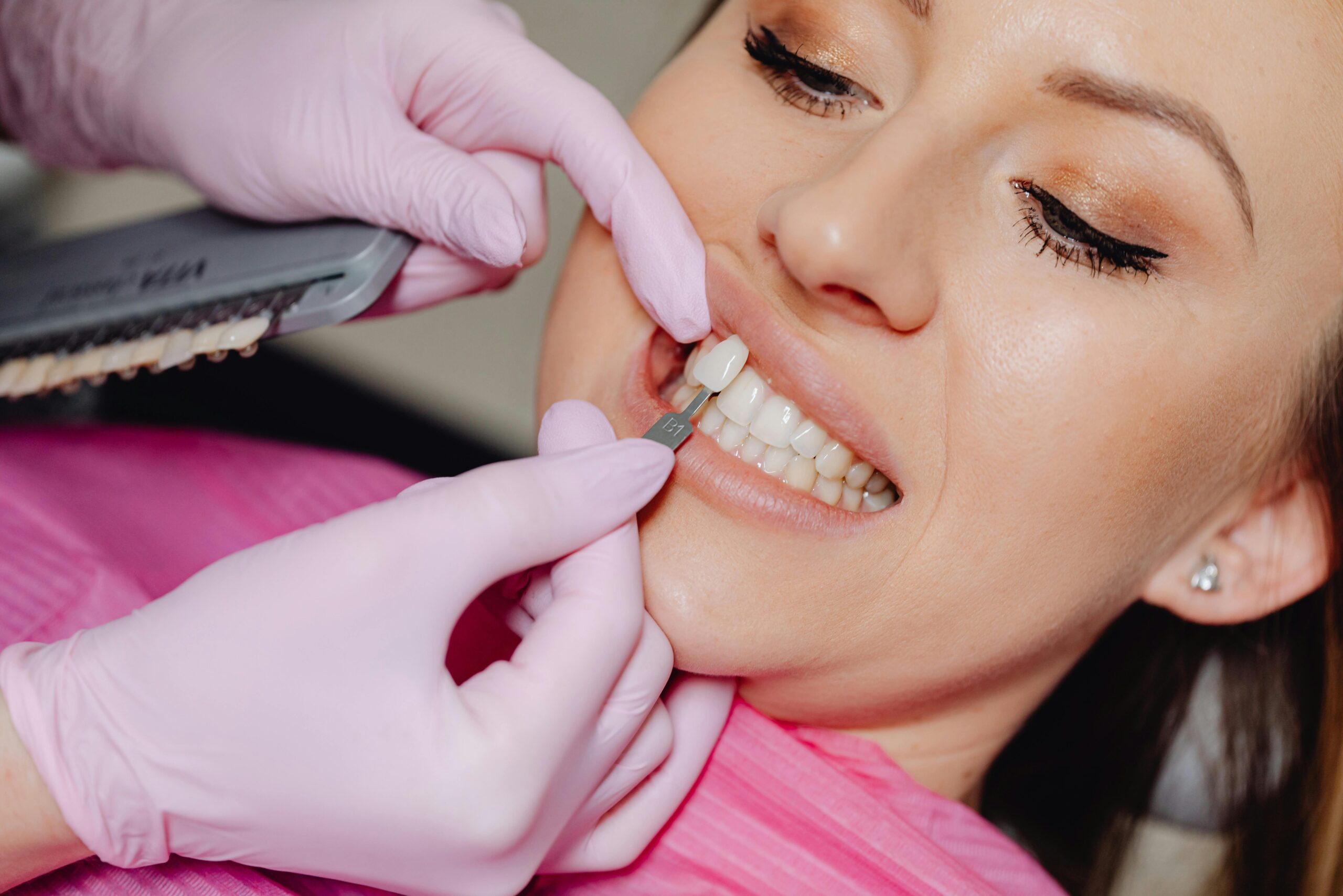 Doctor implementing veneers as cosmetic teeth